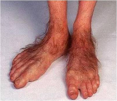 Do You Have Ugly Feet? | Goody Foot